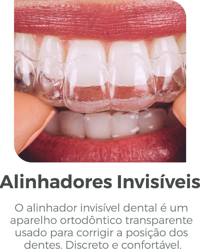ALINHADORES-INVISIVEIS.png