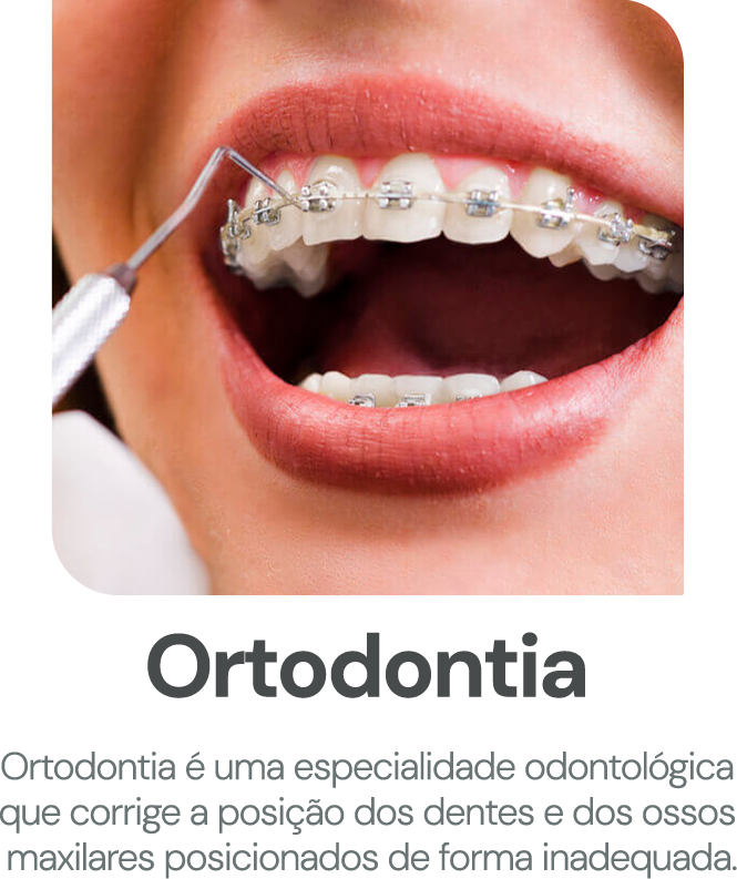 ortodontia-1.png